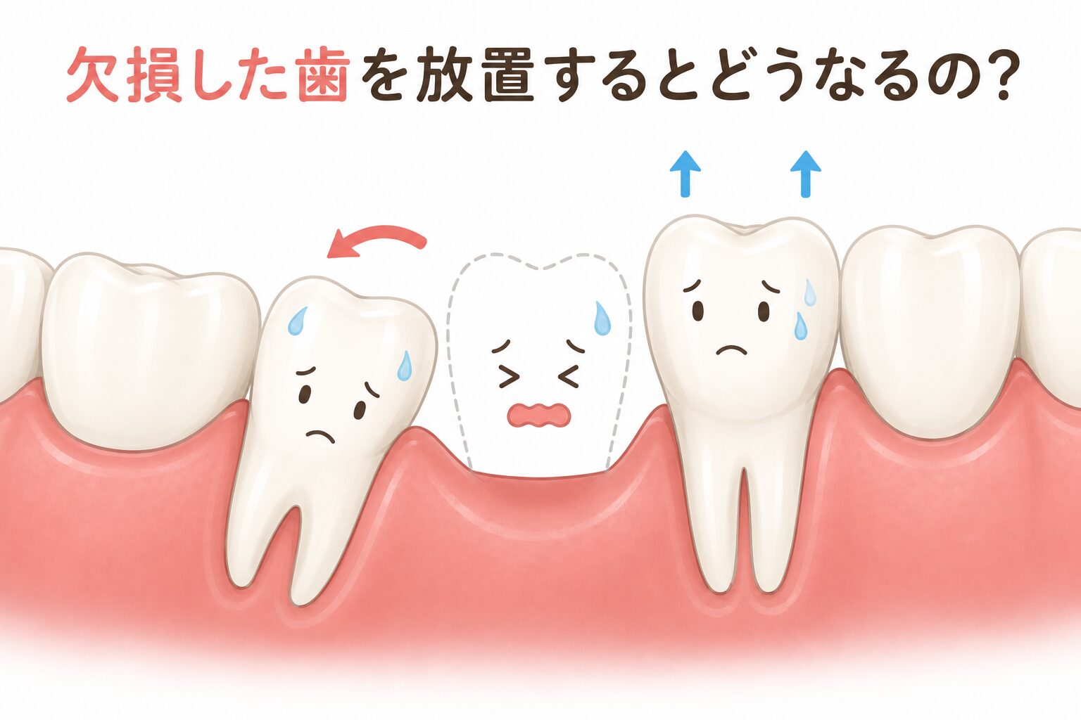 欠損した歯を放置するとどうなるの？のタイトル画像